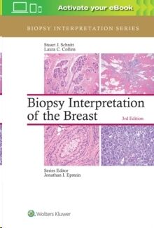 Biopsy Interpretation of the Breast