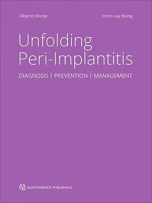 Unfolding Peri-Implantitis. Diagnosis, Prevention, Management, 2ed.