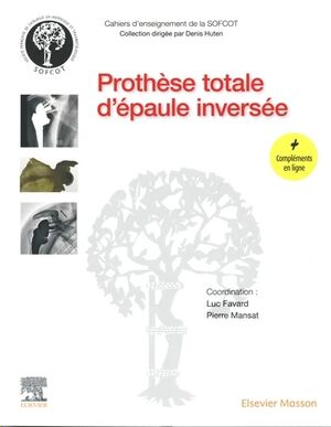 Prothèse totale d'épaule inversée