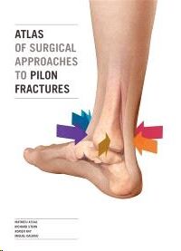 Atlas of surgical approaches to pilon fractures