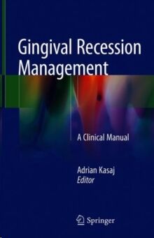 Gingival Recession Management : A Clinical Manual