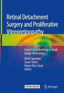 Retinal Detachment Surgery and Proliferative Vitreoretinopathy