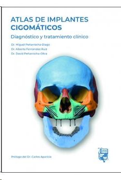 Atlas de implantes Gigomáticos