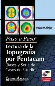 Paso a Paso - Lectura de la Topografia por Pentacam